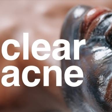 Acne Boot Camp Membership 